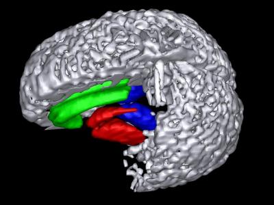 Brain Scans Reveal Cause Of Smokers' Cravings